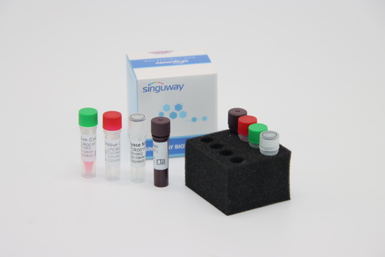Treponema Pallidum TP Virus Fluorescent RT PCR Kit Fast HCV Real Time PCR Kit