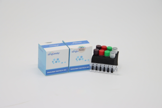 High Precision HIV Real Time PCR Kit POCT IVD Clinical Real Time PCR Diagnostic Kits