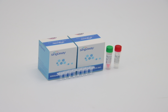 HIV Virus Quantitative Fluorescent PCR Detection Kit POCT Real Time CE