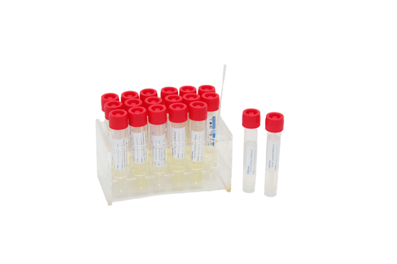 2mL Disposable Virus Sampling Kit Medical VTM Test Tube With Throat Swab Stick