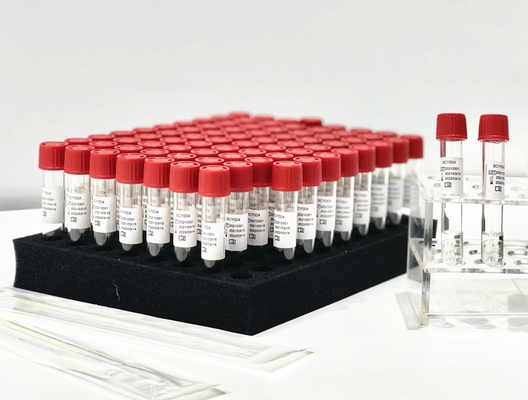One Step Sample Release Reagent PCR Extraction Kit From Patient Pharynx Swab