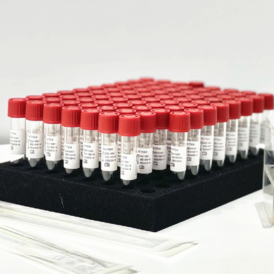 Pharynx Nasal Swab Sample Release Reagent Extraction Kit 0.5mL/ Tube Without Preprocessing