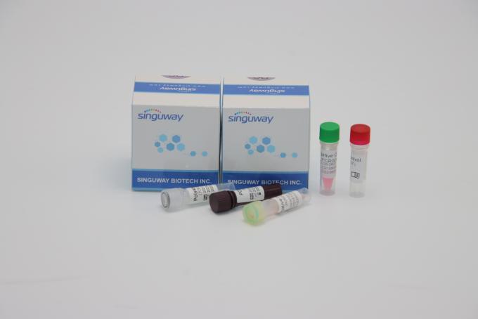 Proflu Fluorescence Probing PCR Detection Kit Nasal Swab Sample For ADV ...